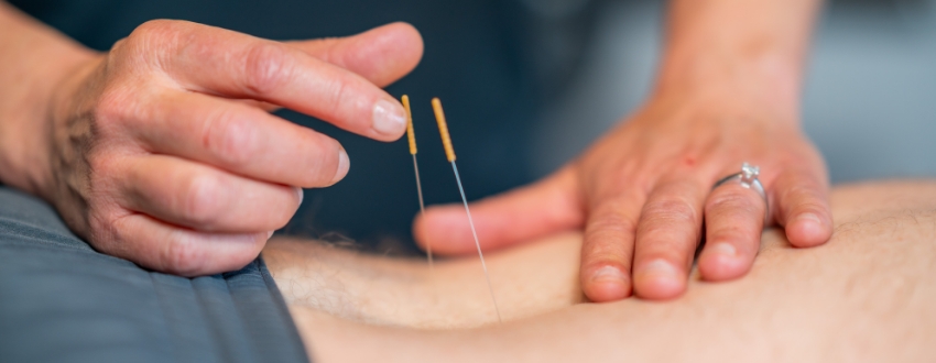 How Dry Needling Can Help You Move and Feel Better